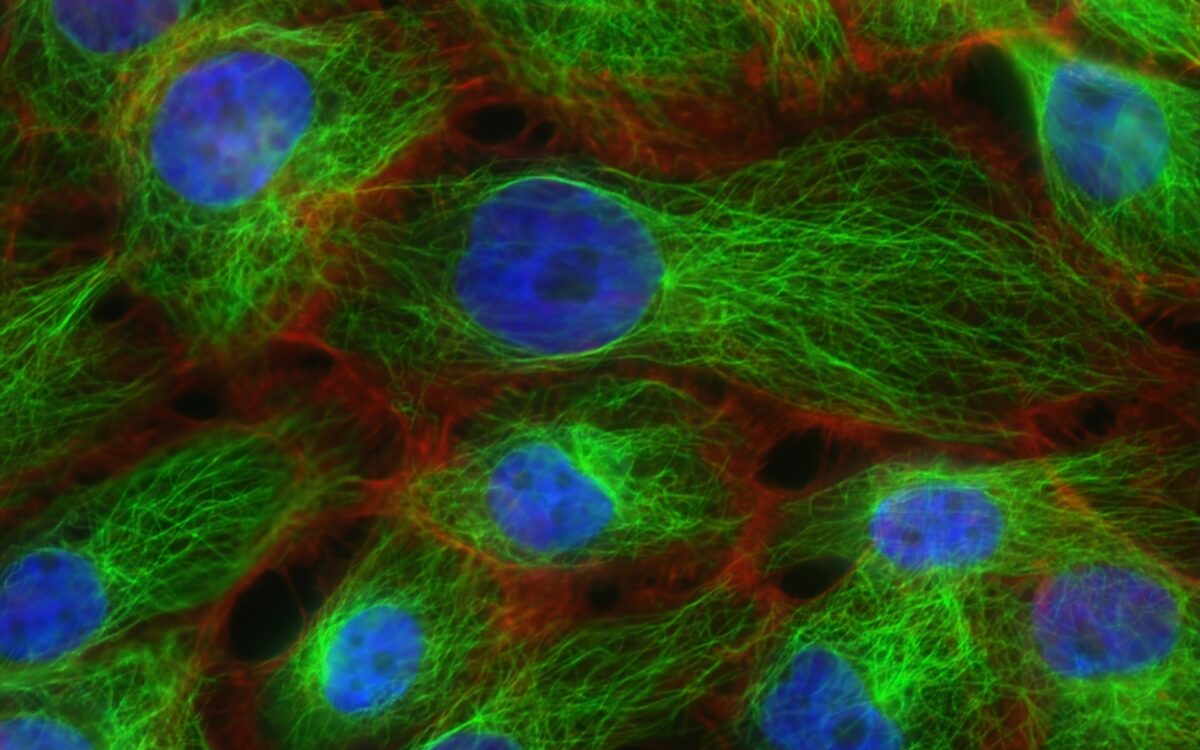 Włókna i mikrotubule komórek nowotworu piersi