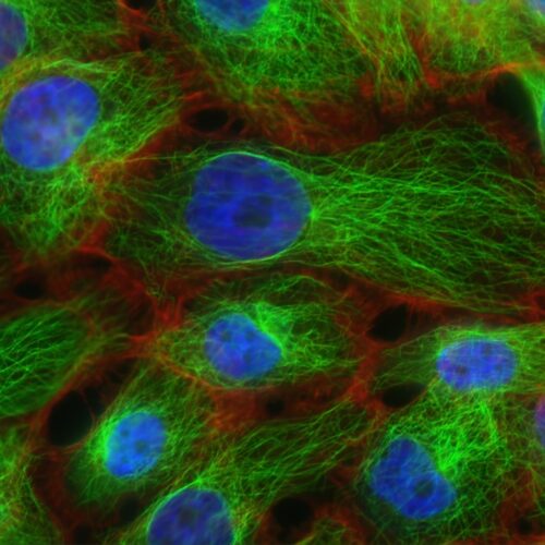 Włókna i mikrotubule komórek nowotworu piersi